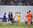 Panică la CSU Craiova » Andrei Ivan s-a accidentat în derby-ul cu FCU Craiova: „La fiecare duel adversarul mă lovește în zona unde am probleme”