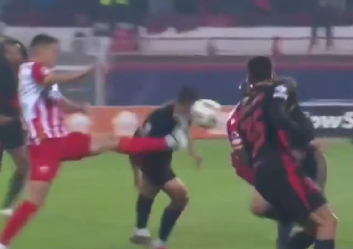 Greu de privit! Imagini HORROR cu fotbalistul Barcelonei » Cum arată după ce a fost șters cu crampoanele pe față în Liga Campionilor