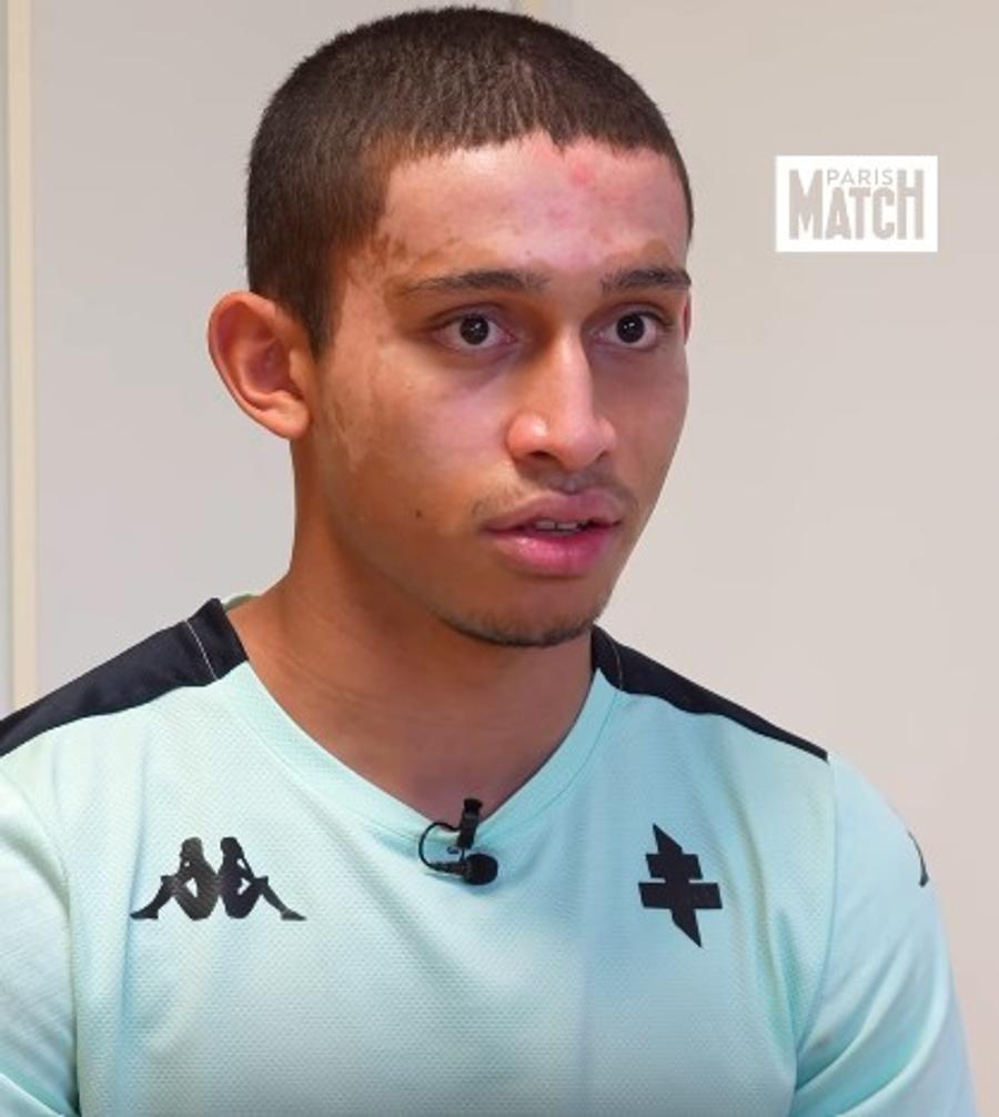 Imagini cu Tahirys Dos Santos din spitalul din Stuttgart, unde a suferit mai multe transplanturi de piele / Foto: X Instagram parismatch Mărturia teribilă a fotbalistului supraviețuitor al tragediei din Crans Montana: „Peste tot erau trupuri arse... ca în scenele de război. Am crezut că voi muri!”