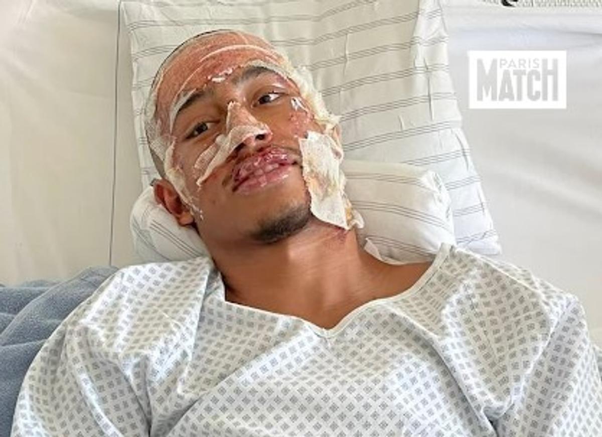 Tahirys Dos Santos își povește drama trăită în incendiul de Anul Nou la Crans Montana