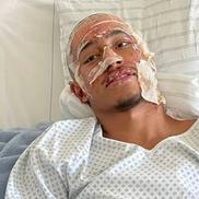 Imagini cu Tahirys Dos Santos din spitalul din Stuttgart, unde a suferit mai multe transplanturi de piele / Foto: X Instagram parismatch