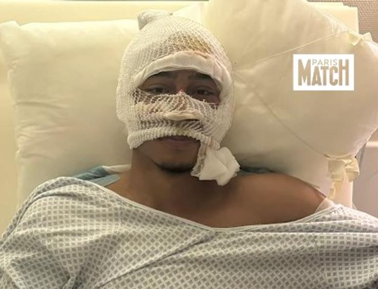 Imagini cu Tahirys Dos Santos din spitalul din Stuttgart, unde a suferit mai multe transplanturi de piele / Foto: X Instagram parismatch