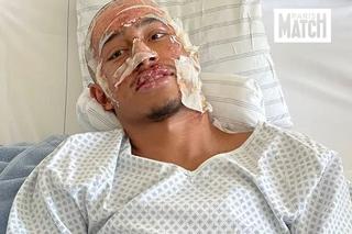 Mărturia teribilă a fotbalistului supraviețuitor al tragediei din Crans Montana: „Peste tot erau trupuri arse... ca în scenele de război. Am crezut că voi muri!”