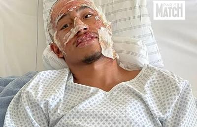 Mărturia teribilă a fotbalistului supraviețuitor al tragediei din Crans Montana: „Peste tot erau trupuri arse... ca în scenele de război. Am crezut că voi muri!”