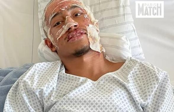 Mărturia teribilă a fotbalistului supraviețuitor al tragediei din Crans Montana: „Peste tot erau trupuri arse... ca în scenele de război. Am crezut că voi muri!”