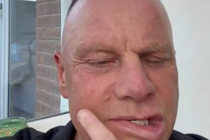 Boala rară cu care se luptă fostul căpitan al lui Manchester City: „Cel mai rău scenariu”
