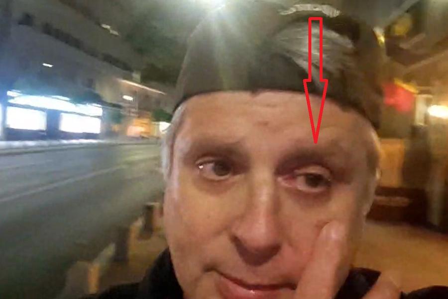„Ceaulșescu” susține că a fost lovit în ochiul stâng de către Mitică și bodyguard-ul său Dumitru Dragomir, conflict violent pe stradă cu protestatarul „Ceaușescu”: „Au dat în mine, nu mai văd cu un ochi!” vs. „M-au înțepat cu șurubelnția, au pus câinele să mă muște”