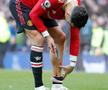 Cristiano Ronaldo, răni după Everton - Manchester United / FOTO: Imago