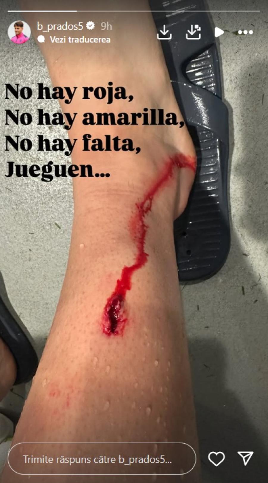 Postarea lui Benat Prados / foto: Instagram Atenție, imagini șocante! Jucătorul lui Bilbao acuză: „Fără cartonaș roșu, fără galben, fără fault, joacă...”