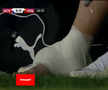 Așa arată glezna lui Koljic / captură Digi Sport 1