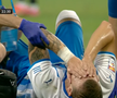 Elvir Koljic, accidentare în CSU Craiova - FC Voluntari