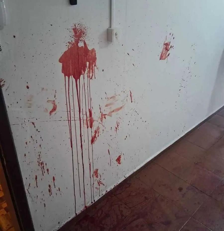 Imagini dure de la scena crimei. Sursa foto: tmz.com Campion de culturism, înjunghiat mortal de iubita lui! Atenție, imagini dure!