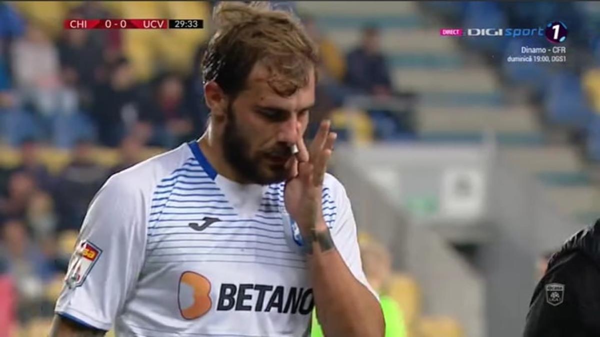CHINDIA - CRAIOVA 1-1 // GALERIE FOTO Josip Ivancic l-a umplut de sânge pe Mihai Bălașa! Fotbalistul Chindiei văzut direct „ROȘU”