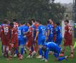 Rezultat îngrijorător pentru Universitatea Craiova în Antalya: liderul din Superligă a fost subordonat de echipa secundă a clubului din Bundesliga