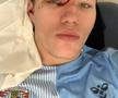 FOTO Callum O'Hare a jucat jumătate de oră cu o accidentare îngrozitoare, iar fanii lui Aston Villa îl vor înapoi! Atenție, imagini cu puternic impact emoțional