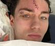 FOTO Callum O'Hare a jucat jumătate de oră cu o accidentare îngrozitoare, iar fanii lui Aston Villa îl vor înapoi! Atenție, imagini cu puternic impact emoțional