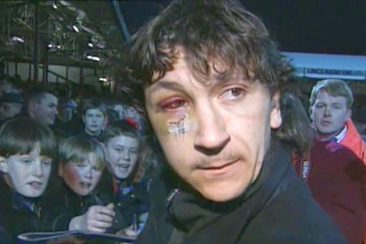 RETRO GSP. Un sfert de veac de la cea mai șocantă accidentare a unui fotbalist
