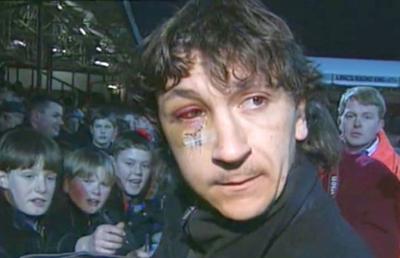 RETRO GSP. Un sfert de veac de la cea mai șocantă accidentare a unui fotbalist