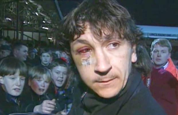 RETRO GSP. Un sfert de veac de la cea mai șocantă accidentare a unui fotbalist