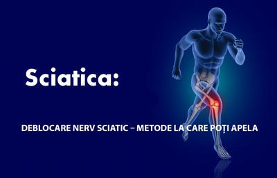 Deblocare nerv sciatic – metode la care poți apela