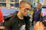 Campion național de box, umplut de sânge de un antrenor! Atenție, imagini dure!
