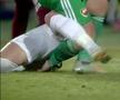 Anass Achahbar, fotbalistul accidentat de Albu, va lipsi până la 7 luni!