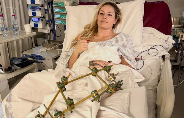 „Cursa a meritat căzătura!” Mesajul emoționant al lui Lindsey Vonn după a patra operație: „Aștept cu nerăbdare momentul în care voi fi din nou în vârful muntelui!”