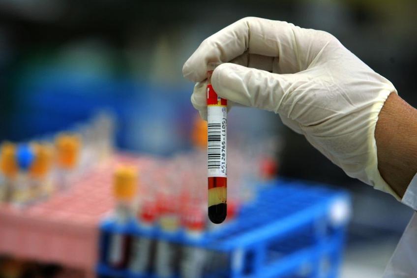 Hendrik Streeck a efectuat un studiu pentru a observa mai bine efectele pe care le are coronavirusul. foto: Guliver/Getty Images