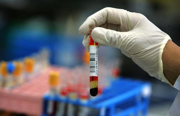 CORONAVIRUS. Hendrik Streeck, un virusolog german, demontează teoriile despre COVID-19 » Cât de ridicat e pericolul când mergi la cumpărături