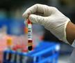 Hendrik Streeck a efectuat un studiu pentru a observa mai bine efectele pe care le are coronavirusul. foto: Guliver/Getty Images