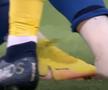 Cât de grave sunt accidentările lui Miculescu și Șut: „Are o entorsă de genunchi, se pare că la ligamentul colateral extern”
