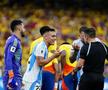 Columbia - Argentina