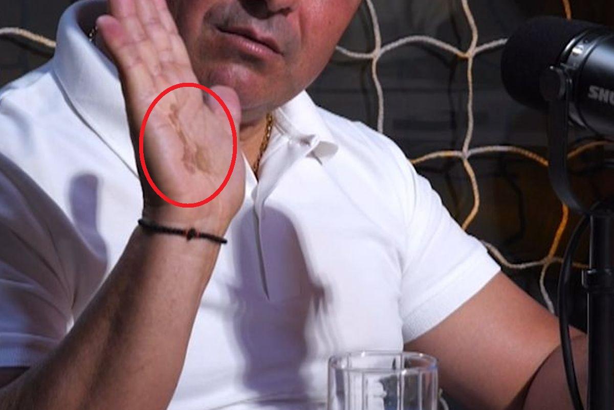 La un pas de tragedie » Imagini dure la podcastul GSP „2 la 1”: „Era să mor. Uitați-vă la mâna mea”