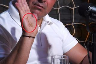 La un pas de tragedie » Imagini dure la podcastul GSP „2 la 1”: „Era să mor. Uitați-vă la mâna mea”