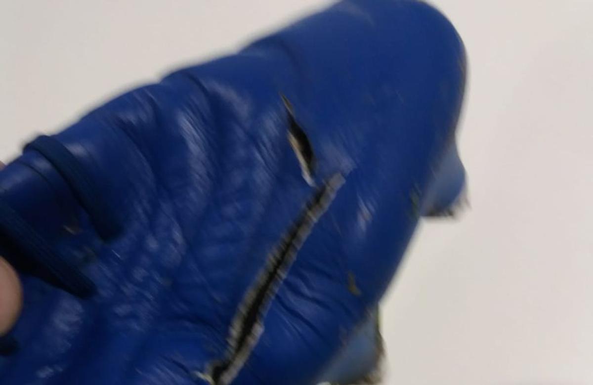 FOTO EXCLUSIV. I-a tăiat gheata în Craiova - Sepsi! Cum arată acum piciorul fotbalistului » Crăciunescu: „I-aș fi dat «roșu»!”