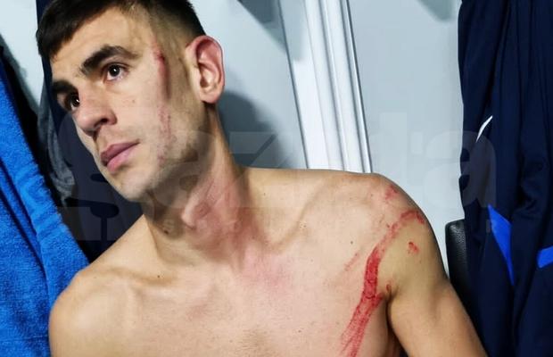 Edjouma, iertat de eliminare la Voluntari! Intrarea horror a francezului a lăsat urme: „Fault grosolan! Trebuia ROȘU direct! Ce face VAR-ul?”