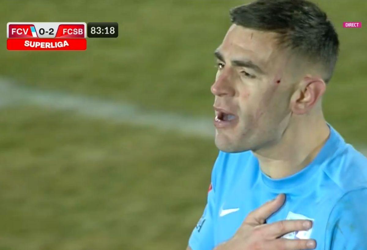Edjouma, iertat de eliminare la Voluntari! Intrarea horror a francezului a lăsat urme: „Fault grosolan! Trebuia ROȘU direct! Ce face VAR-ul?”