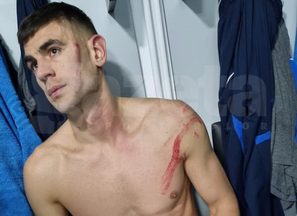 Fault Edjouma - Armaș în FC Voluntari - FCSB