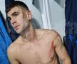 Edjouma, iertat de eliminare la Voluntari! Intrarea horror a francezului a lăsat urme: „Fault grosolan! Trebuia ROȘU direct! Ce face VAR-ul?”