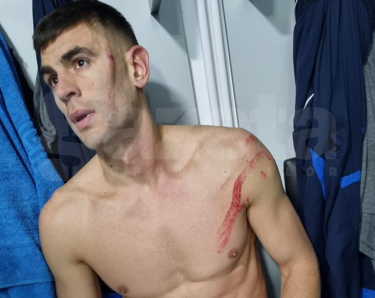 Edjouma, mesaj la miezul nopții după faultul de K1 asupra lui Armaș: „Am făcut o greșeală”