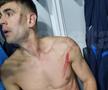Edjouma, iertat de eliminare la Voluntari! Intrarea horror a francezului a lăsat urme: „Fault grosolan! Trebuia ROȘU direct! Ce face VAR-ul?”