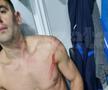 Edjouma, iertat de eliminare la Voluntari! Intrarea horror a francezului a lăsat urme: „Fault grosolan! Trebuia ROȘU direct! Ce face VAR-ul?”