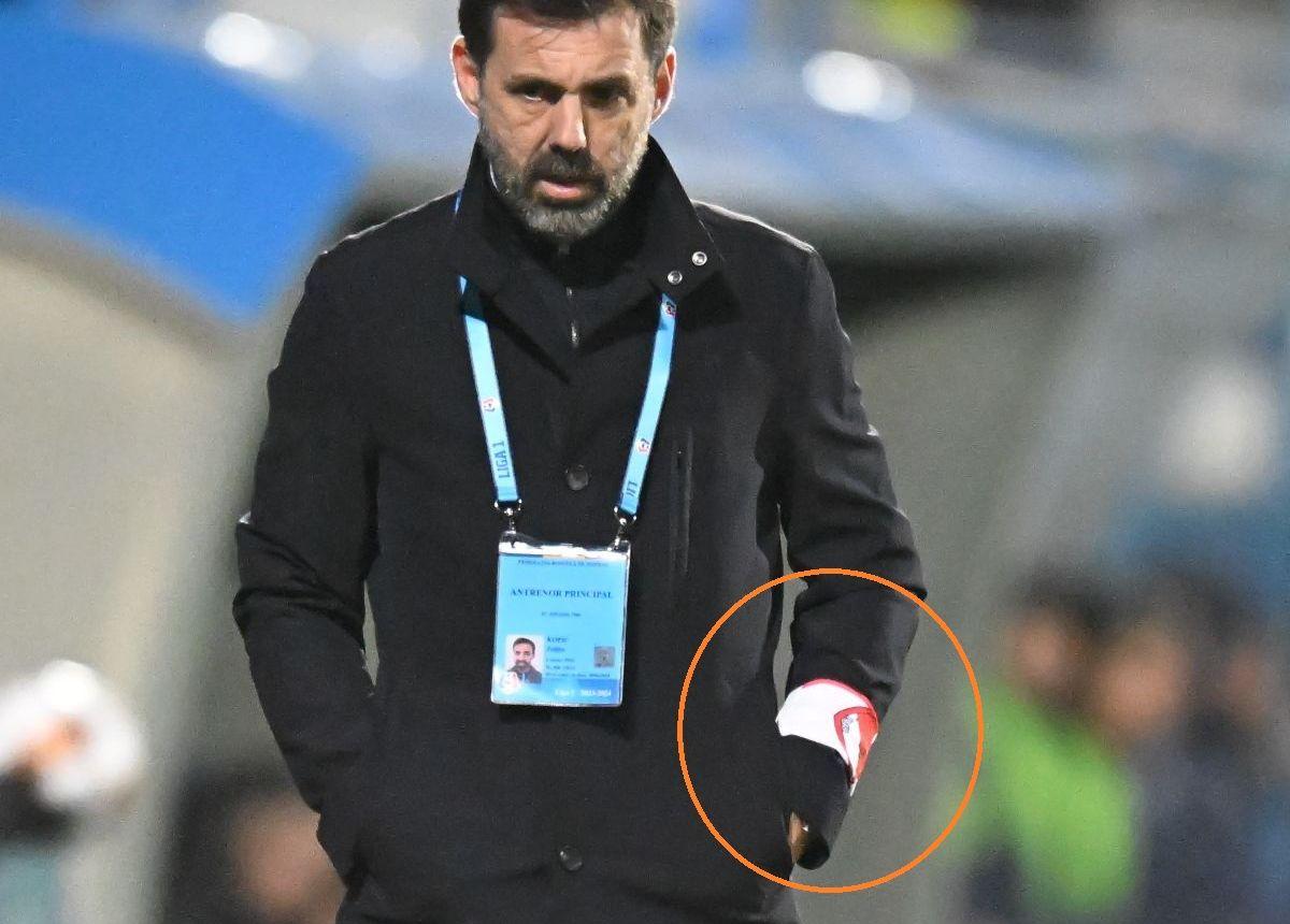 Cum a apărut Kopic la meciul cu Farul » Detaliul observat de reporterii GSP pe brațul antrenorului lui Dinamo + explicația acestuia: „Vreau să jucăm ca ei!”