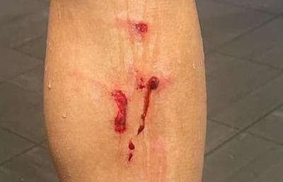 Atenție! Agresivitate peste orice limită. Tacklingul la minge poate umple piciorul de sânge » Crampoane pe tibie!