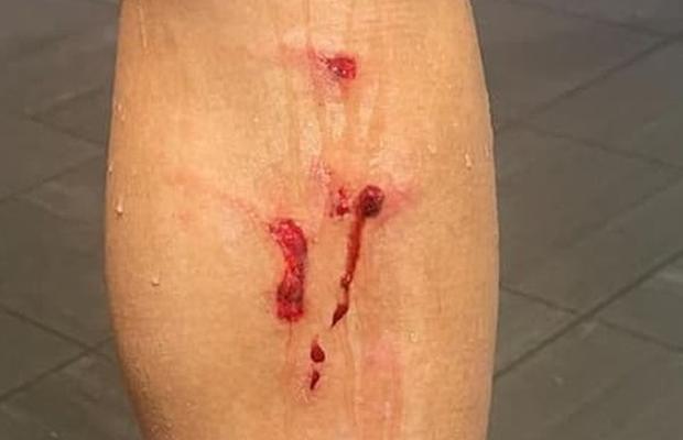 Atenție! Agresivitate peste orice limită. Tacklingul la minge poate umple piciorul de sânge » Crampoane pe tibie!