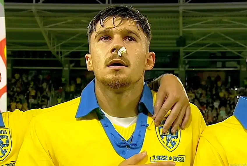 România - Finlanda 1-0 » Gazeta a aflat motivul pentru care Deian Sorescu (24, extremă dreapta) și Andrei Rațiu (23, fundaș dreapta) au avut hemoragie nazală înaintea meciului cu Finlanda, de sâmbătă. Sorescu a ratat intonarea imnurilor.