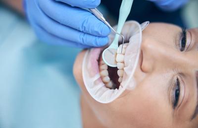 Importanța igienei orale post-implant dentar