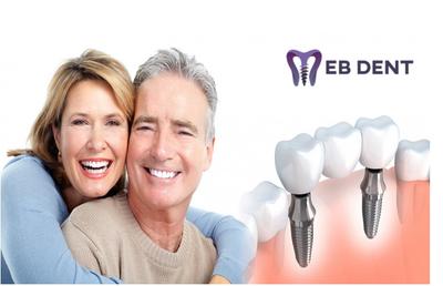 Afla ce este si ce presupune un impant dentar!