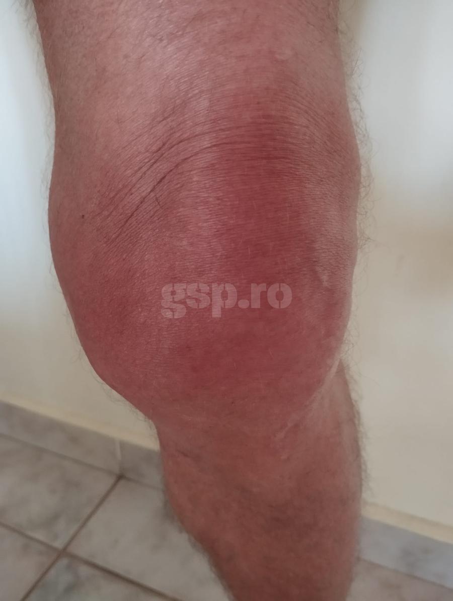 Așa arată azi genunchiul stâng al lui Constantin Bârboră Trebuia să fie urmașul lui Hagi, dar a jucat 7 ani cu genunchii distruși: „Abia mai merg!” + Condiția pusă de Valentin Ceaușescu la Steaua și discuția ireală cu Lucescu: „Dă-ți pantalonii jos!”