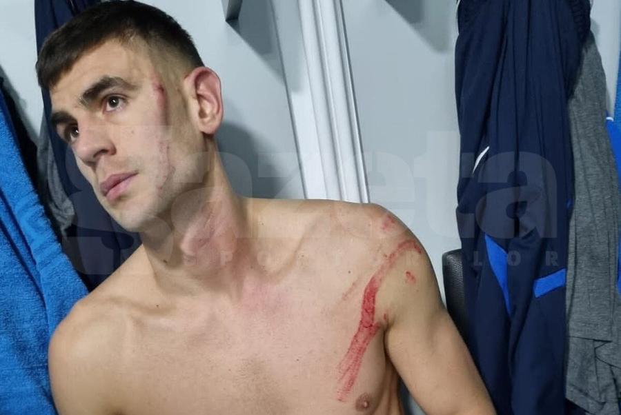 Igor Armaș, după lovitura primită de la Edjouma Răzvan Burleanu, despre scandalul de arbitraj din Rapid - FCSB: „Becali e supărat? Să îi amintesc atunci despre aceste două meciuri”